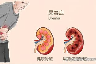 纳乔单赛季西甲两次被罚下场，皇马球员自拉莫斯以来首位